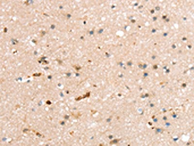 RASGEF1A Antibody