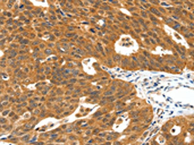 PLAT Antibody