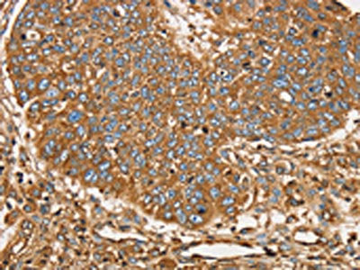 SCD Antibody