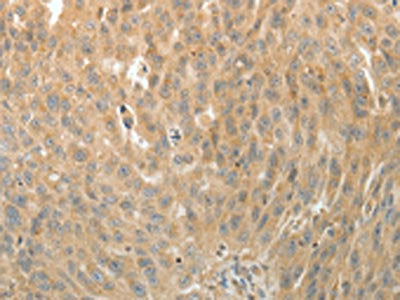 MAP4 Antibody