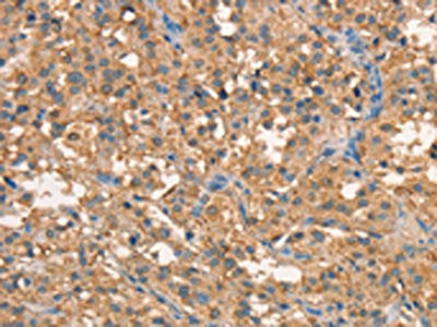CRELD1 Antibody