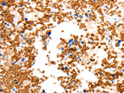 SLC2A5 Antibody