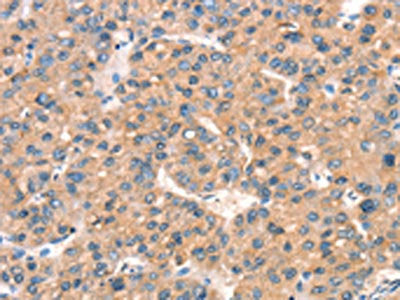 ARHGAP4 Antibody