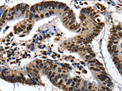 XRCC6 Antibody