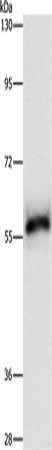 HCK Antibody