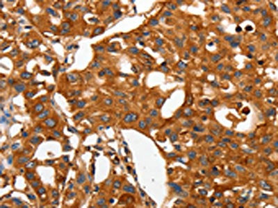 CAP2 Antibody