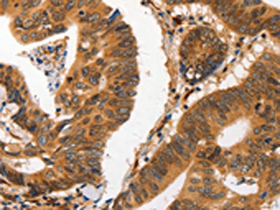 CA2 Antibody