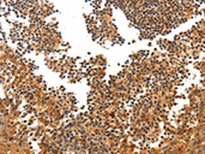 TERT Antibody