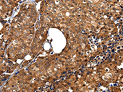 ZBTB2 Antibody