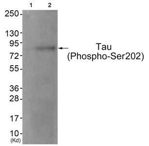 Phospho-MAPT (Ser202) Antibody