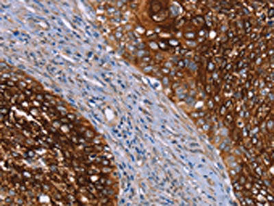 CRH Antibody