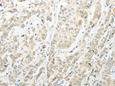 AGBL1 Antibody