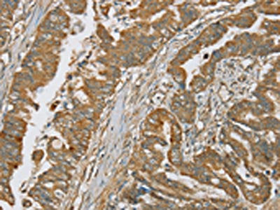 SERPING1 Antibody