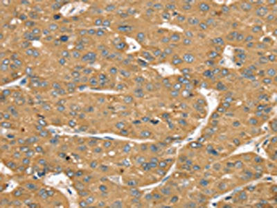 SLIT1 Antibody
