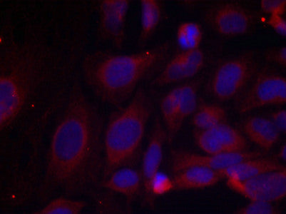 Phospho-NFKB1 (Ser893) Antibody