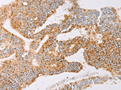 YARS2 Antibody