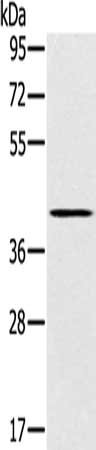 SLC14A1 Antibody