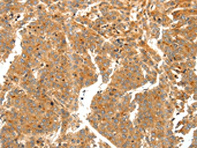 SCT Antibody