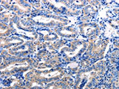 NFKB1 Antibody