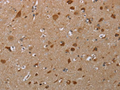 MARK1 Antibody