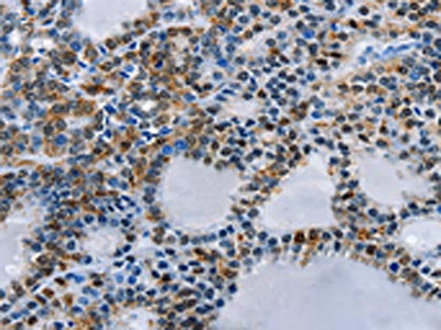 BCOR Antibody