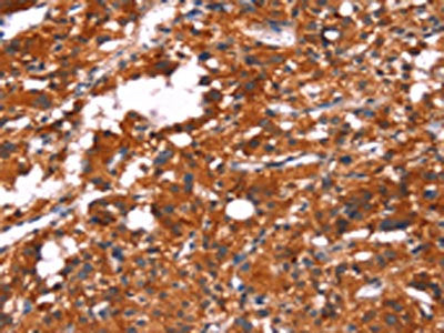 FEM1A Antibody