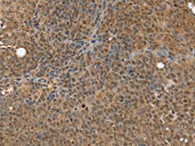 MED12 Antibody