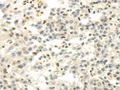 CDKN1A Antibody