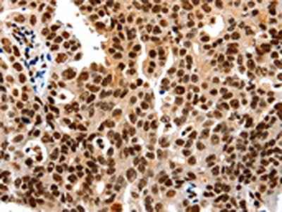 HDAC2 Antibody