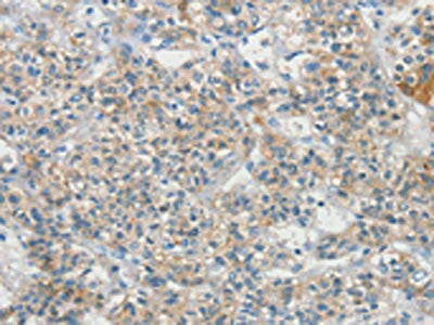 SCN9A Antibody