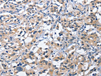 CEACAM3 Antibody