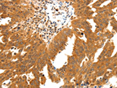 SSTR2 Antibody