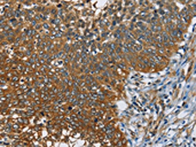 CAST Antibody