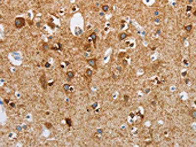 NEK5 Antibody