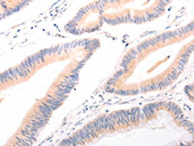 ACR Antibody