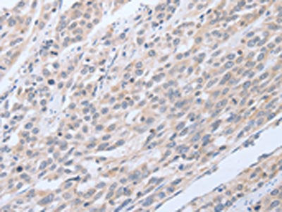TNK2 Antibody