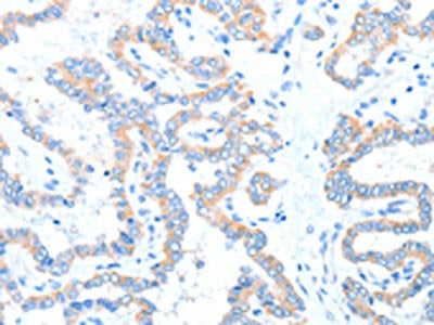ADAM17 Antibody