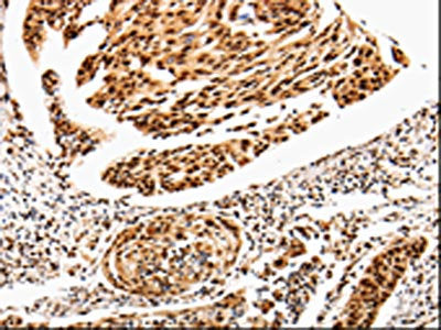 ANGPTL4 Antibody