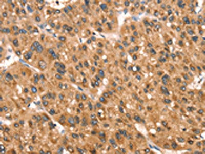 DAP Antibody
