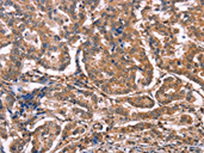 MAP3K2 Antibody