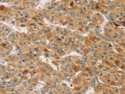 TRIM40 Antibody
