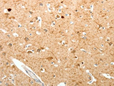 PVALB Antibody
