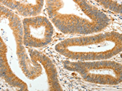 AKR1B1 Antibody