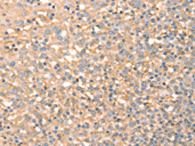 SLC4A7 Antibody