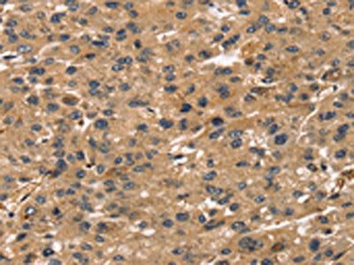 TMSB4X Antibody