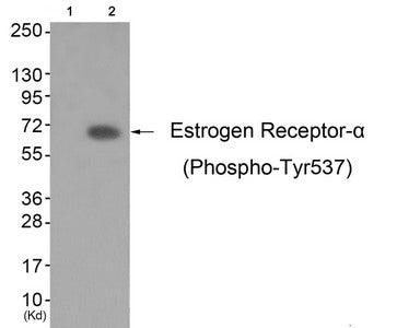 Phospho-ESR1 (Tyr537) Antibody