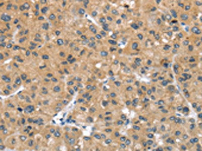 UCP3 Antibody