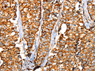 SLC25A3 Antibody