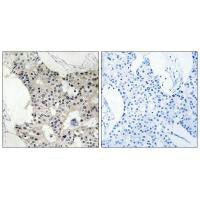 BAGE4 Antibody