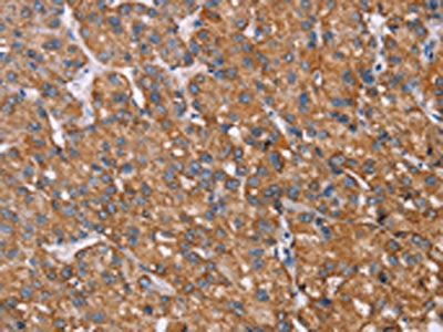 RMDN3 Antibody